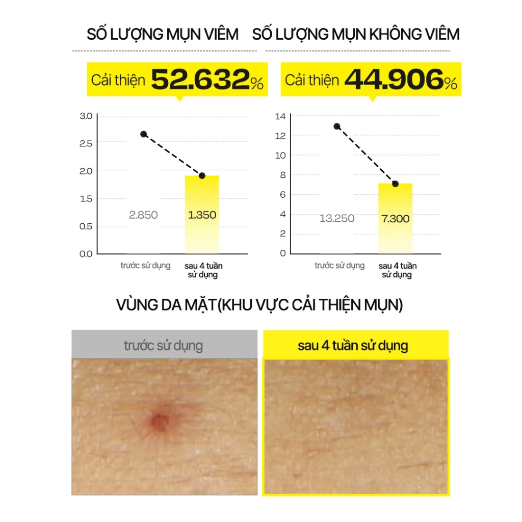 d'Alba First Spray Serum