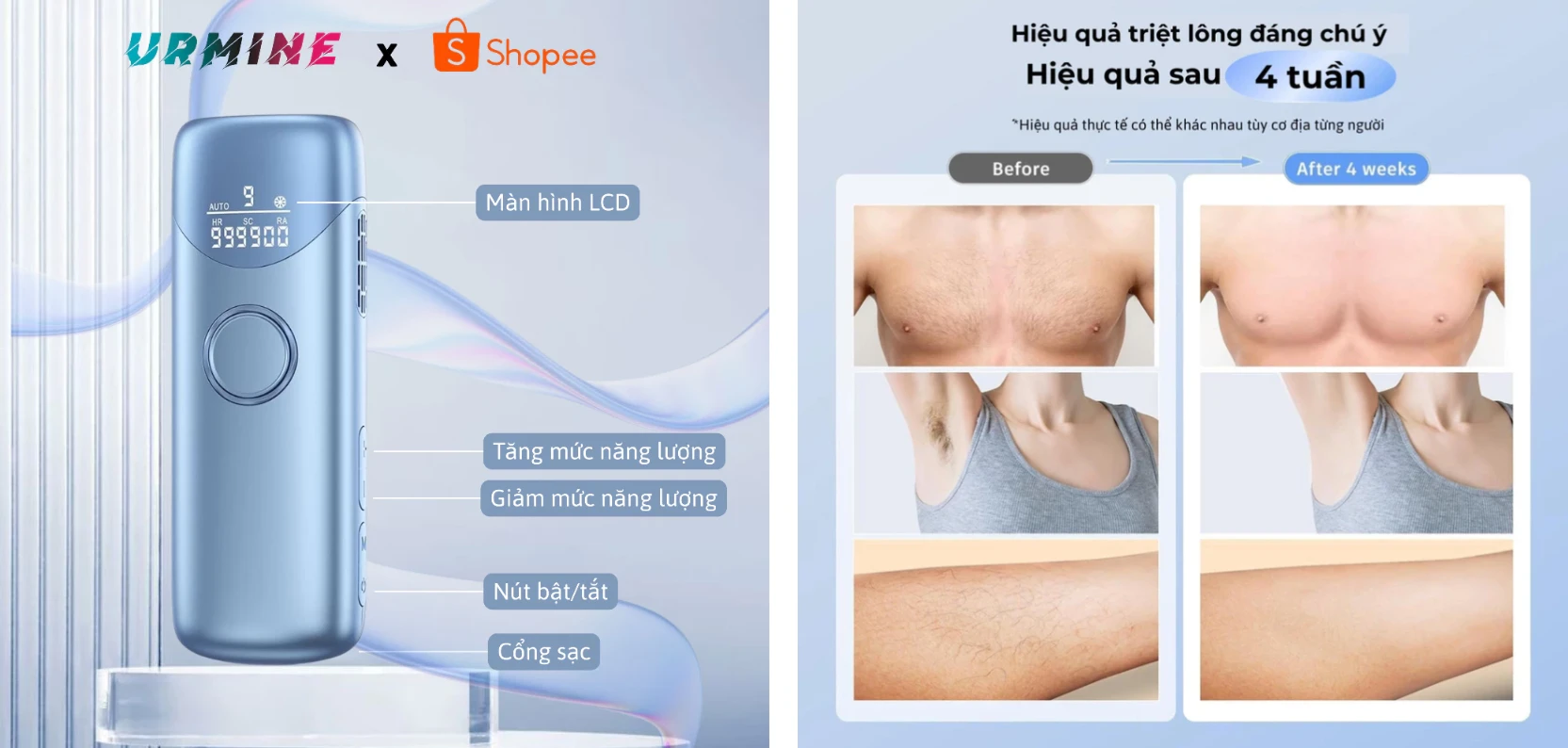 Máy triệt lông URMINE