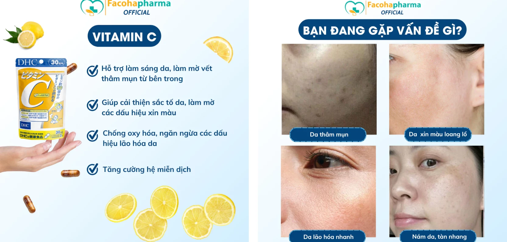 Viên uống vitamin C DHC