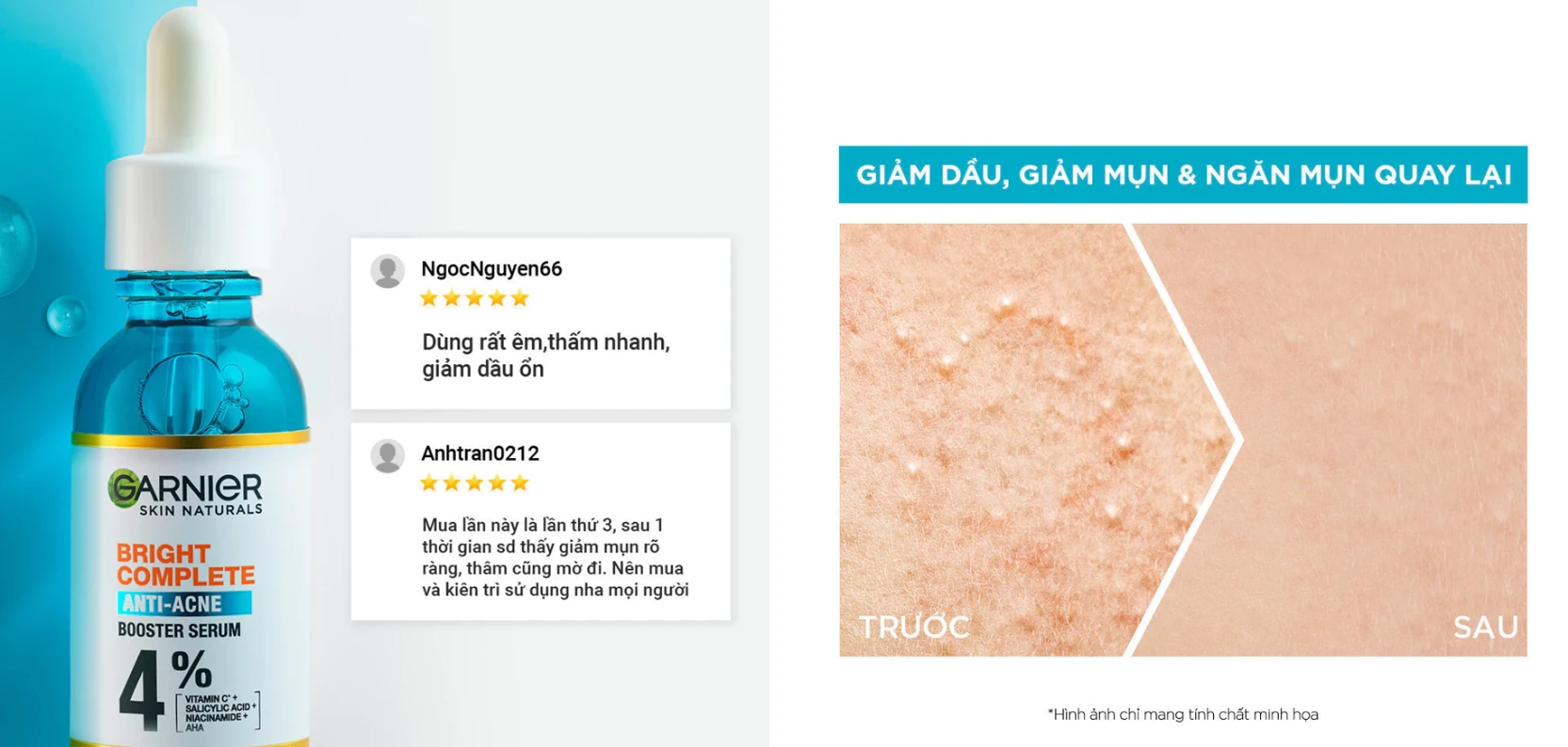 Serum Garnier trị mụn