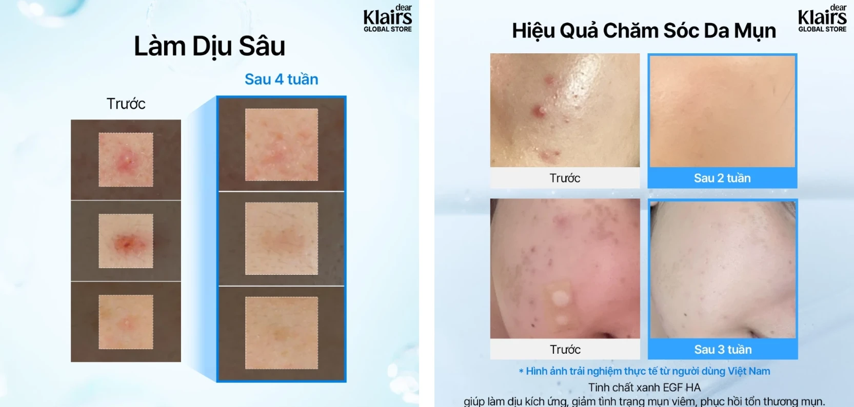 Serum Dear Klairs